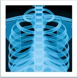 X-Ray — Apple