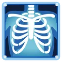 엑스레이